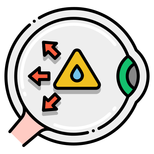 Glaucoma treatment in Dhanbad